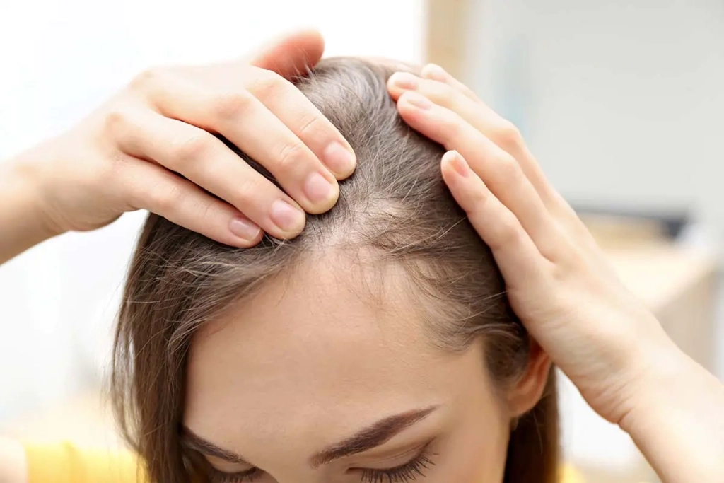 La chute & repousse de vos cheveux